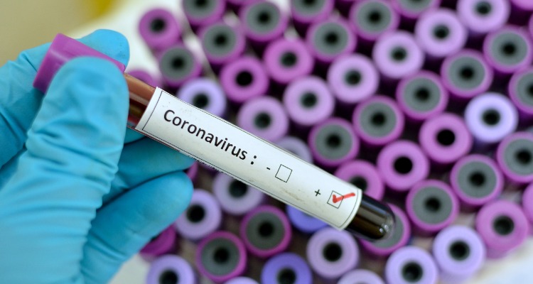 Coronavirus: The FIQ encourages its members to stay informed to stay protected